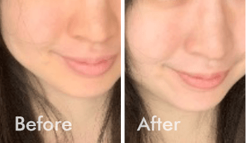 莊小姐使用後氣色整體很自然