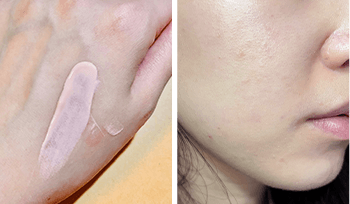 蘇小姐使用後提亮膚色遮住臉上原有的泛紅和微細血管