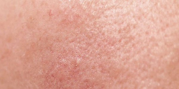 物理性煥膚的男性肌膚