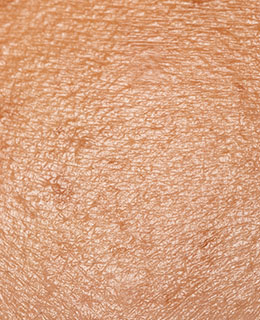 毛孔出油的男性肌膚